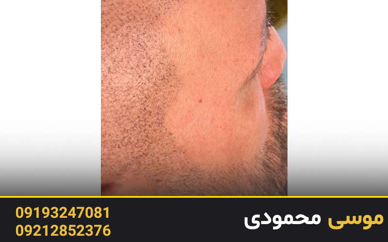 اسکالپ سه بعدی در میکرو غرب