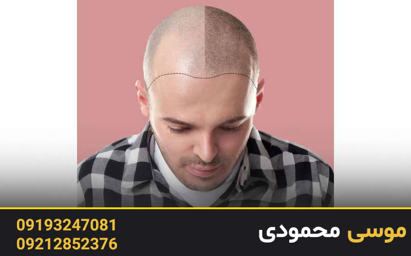 مزایای اسکالپ 3D