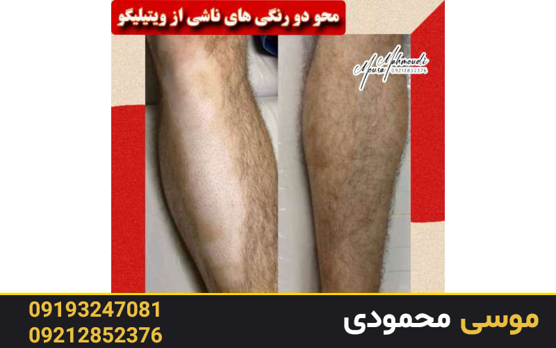 کاربردهای کاموفلاژ دائم