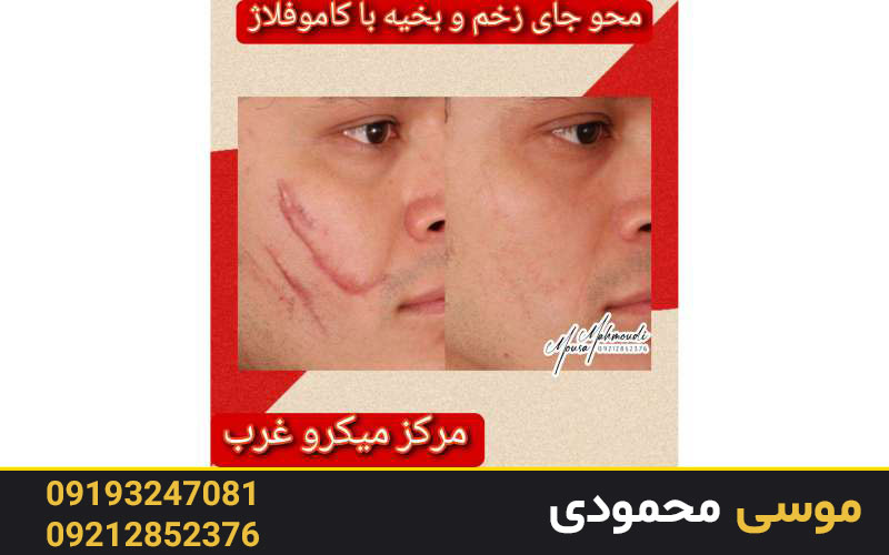 آشنایی با کاموفلاژ