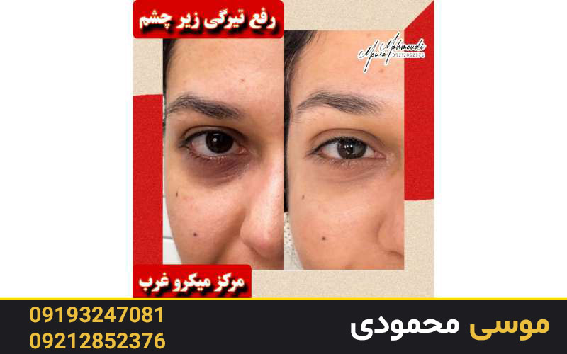 کاموفلاژ نخودی