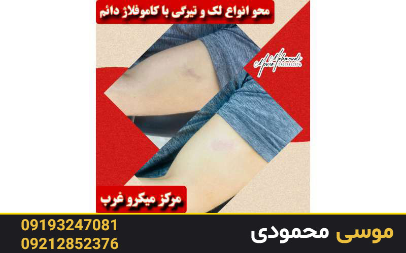 انجام خدمات کاموفلاژ دائم در آکادمی میکرو غرب