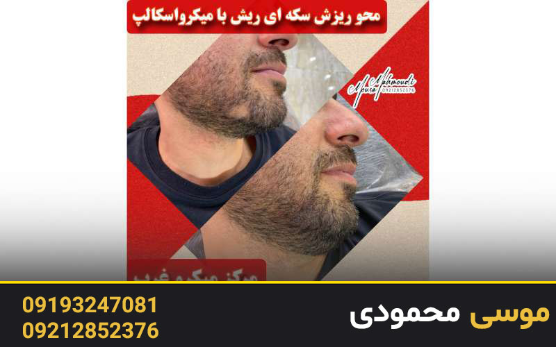 نکات مهم در آموزش میکروبلیدینگ ابرو