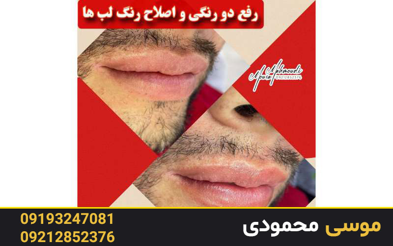 میکرو غرب بهترین مرکز رژ لب دائم آقایان و خانم ها