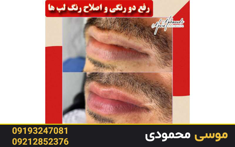 عوارض رژ لب دائم چیست؟