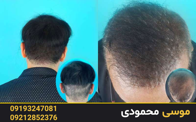 شرایط شرکت در دوره آموزش اسکالپ سر